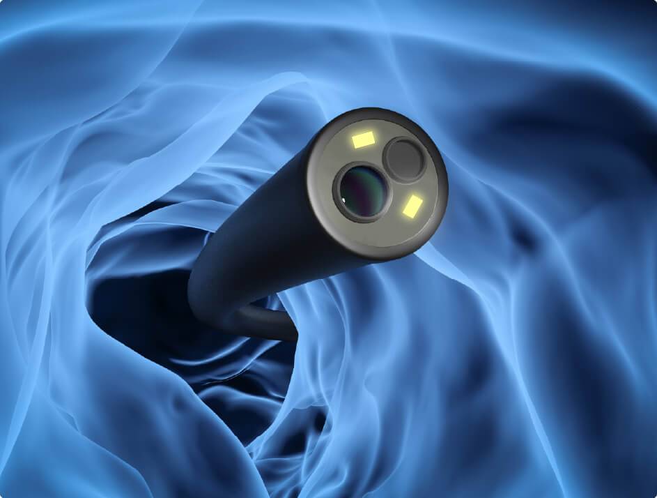 鼹鼠医疗和您聊聊：可视喉镜与电子支气管镜维护保养